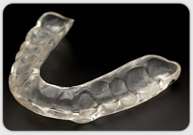 Сплит капа для зубов: что это и как она помогает